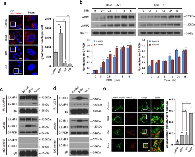 Fig. 3: BBM blocks autophagosome-lysosome fusion but does not alter the lysosome pH.