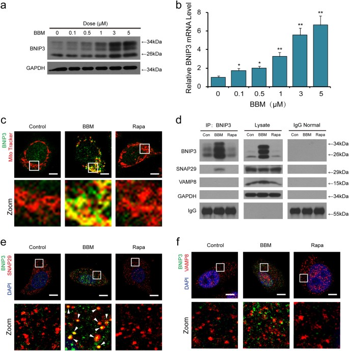 Fig. 5: BBM induces upregulation of BNIP3 and the interaction of SNAP29 and BNIP3.