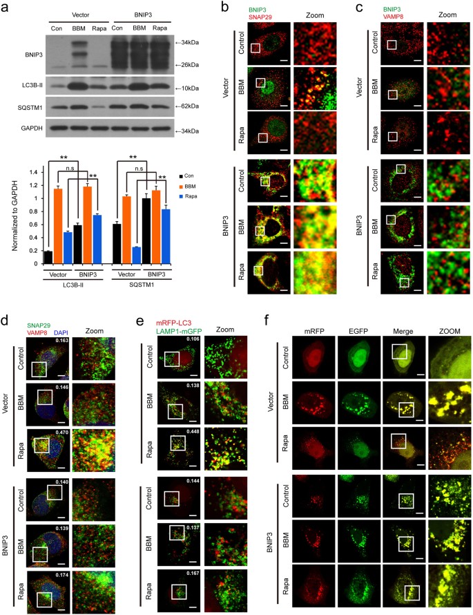 Fig. 7: BNIP3 overexpression blocks autophagosome-lysosome fusion through inhibition of the interaction between SNAP29 and VAMP8.