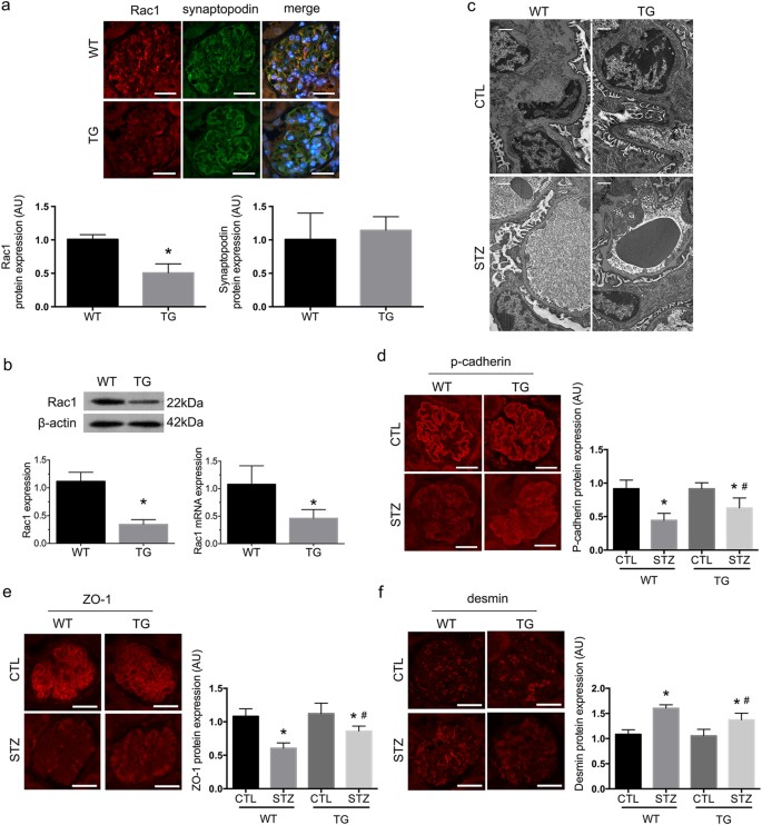 Fig. 1: Characterization of podocyte-specific Rac1 TG mice and effects of podocyte Rac1 deficiency on diabetic glomeruli at  6 weeks.