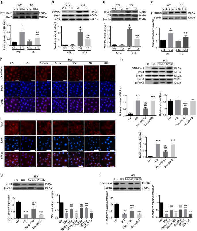 Fig. 3: Activation of Rac1/PAK1/p38 signaling cascade in vivo and in vitro.