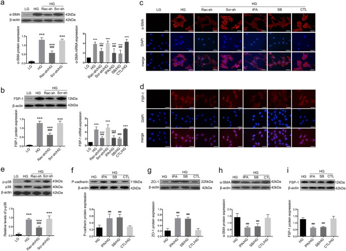 Fig. 4: Effects of Rac1/PAK1/p38 pathway on fibroblastic markers under HG conditions.