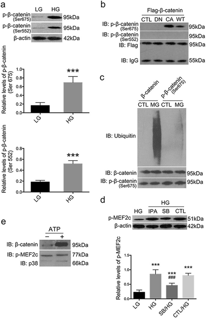 Fig. 6: Interplays between Rac1/PAK1/p38 and β-catenin in podocytes under culture.