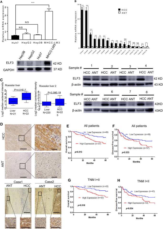 Fig. 1: Expression of analyses of ELF3 mRNA and protein in HCC cell lines and tissues.