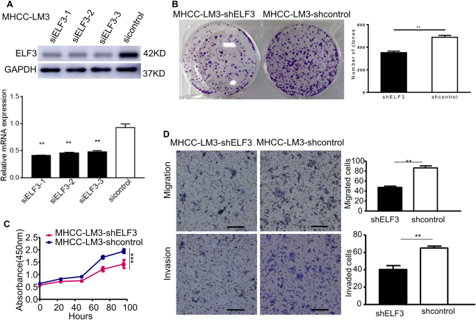 Fig. 3: Down-regulation of ELF3 inhibited the proliferation, migration, and invasion of HCC cell in vitro.