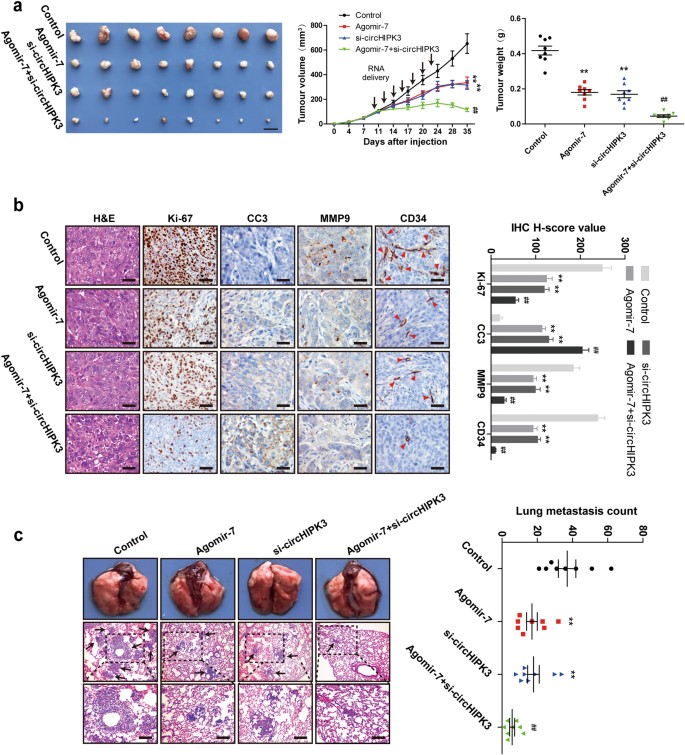 Fig. 6: CircHIPK3 silencing retards tumor progression and combined with miR-7 overexpression exhibits a magnifying effect on tumor repression in vivo.
