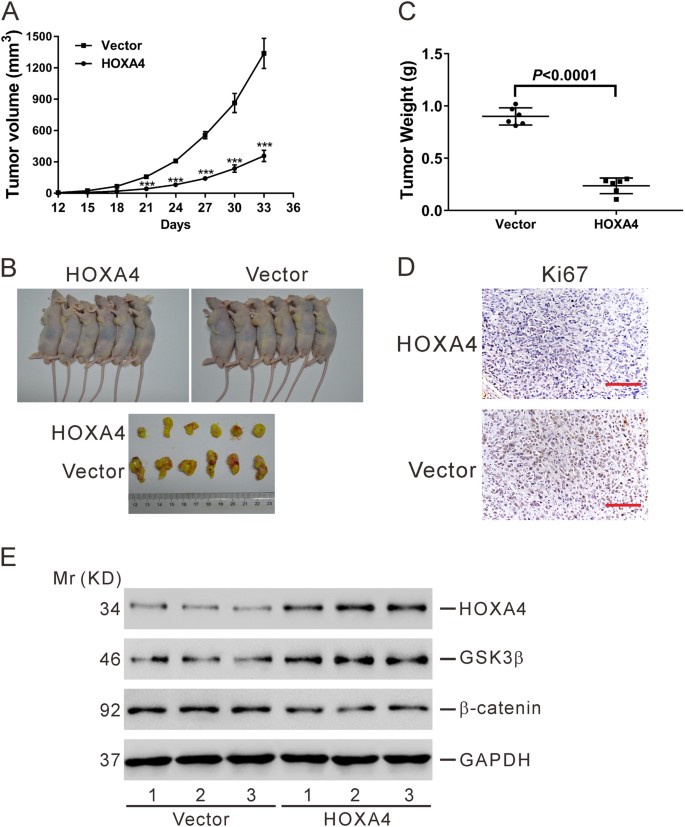 Fig. 8: HOXA4 inhibited tumorigenesis of lung cancer cells in vivo.