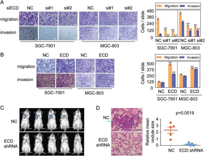 Fig. 2: ECD promotes GC migration and invasion in vitro and metastasis in vivo.