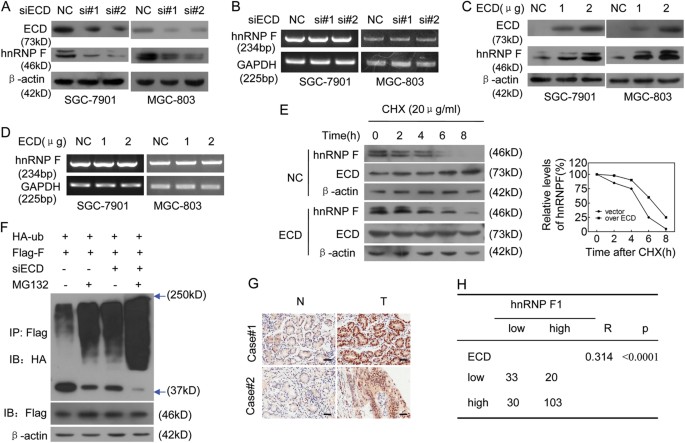 Fig. 4: ECD upregulates hnRNP F protein expression levels by stabilizing hnRNP F.