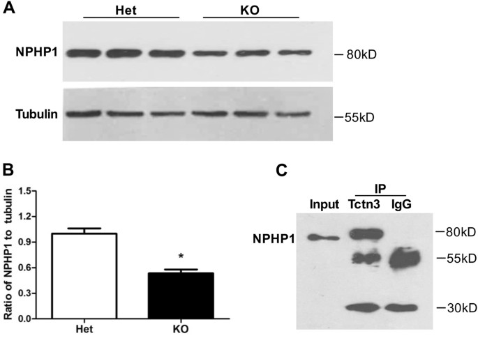 Fig. 7: Tctn3 KO decreased NPHP1 expression at E12.5.