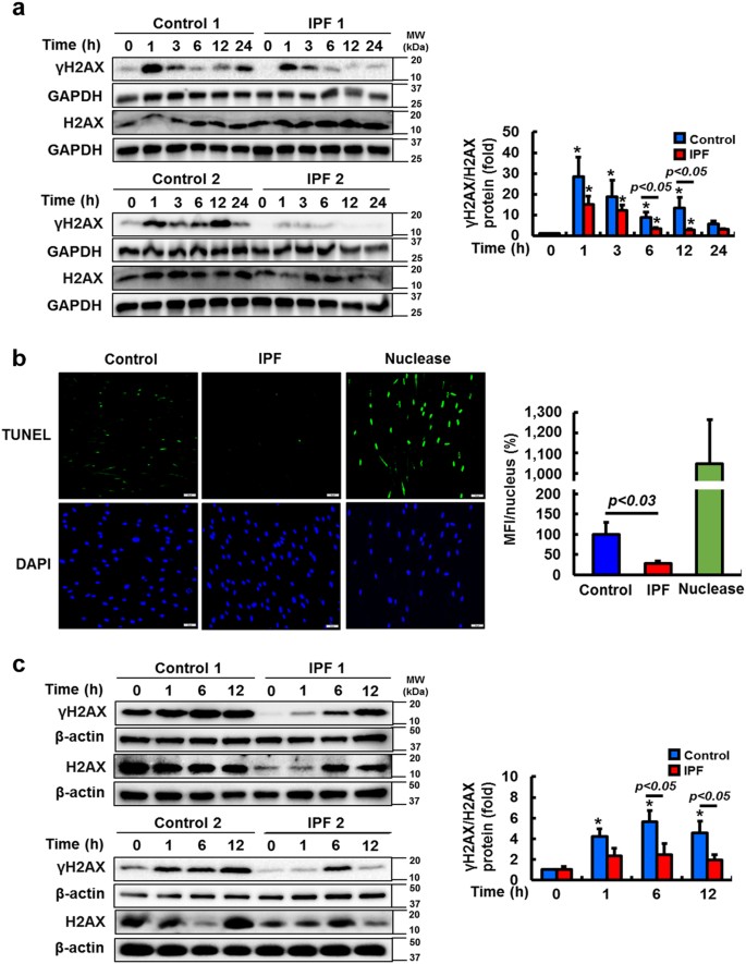 Fig. 2: IPF fibroblasts show lower γH2AX expression and decreased DNA fragmentation following irradiation or bleomycin treatment.