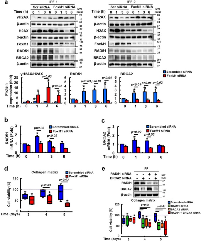 Fig. 4: FoxM1 inhibition sensitizes IPF fibroblasts to radiation-induced cell death by suppressing RAD51 and BRCA2.