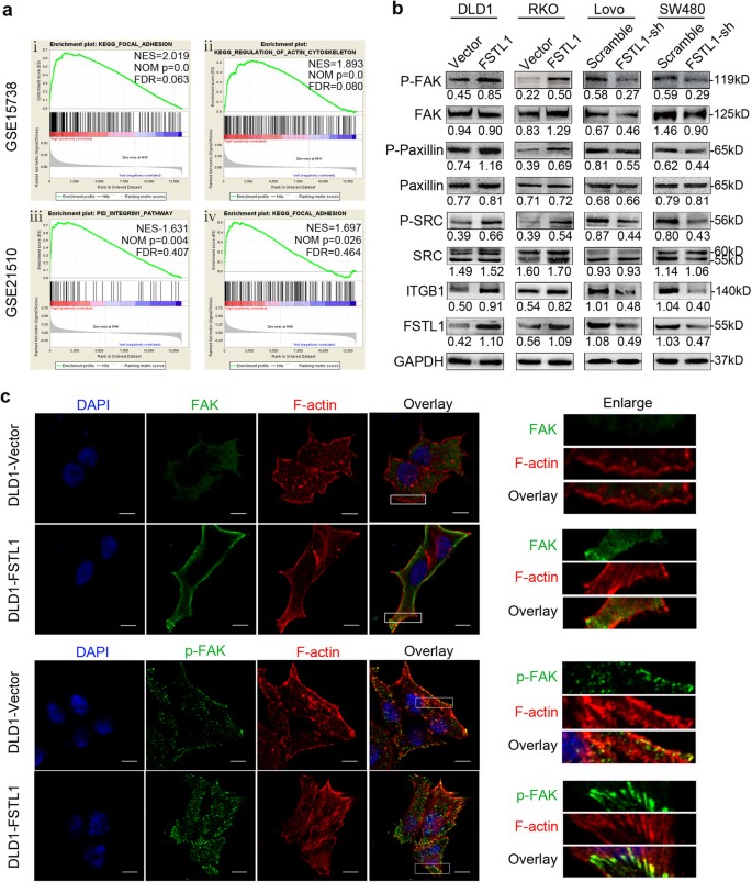 FSTL1 interacts with VIM and promotes colorectal cancer metastasis 
