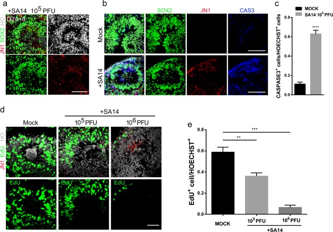 Fig. 2: Modeling JEV infection during cortical neurogenesis.