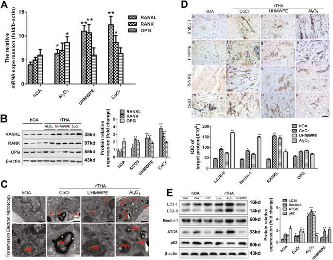 Fig. 2: Autophagy induced by wear debris and expression of RANKL, RANK, OPG in the synovial tissue of patients with rTHA.