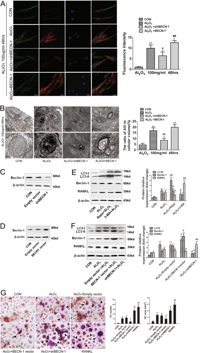 Fig. 4: Autophagy induced by Al2O3 particles mediated the expression of RANKL in FLSs