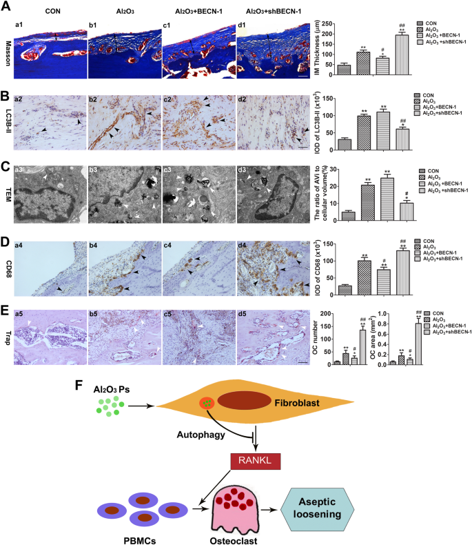 Fig. 6: Autophagy mediated periprosthetic osteolysis in the rat model of biological femoral head replacement.