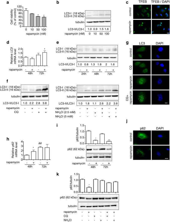 Dual Role Of Autophagy On Docetaxel Sensitivity In Prostate Cancer Cells Cell Death Disease