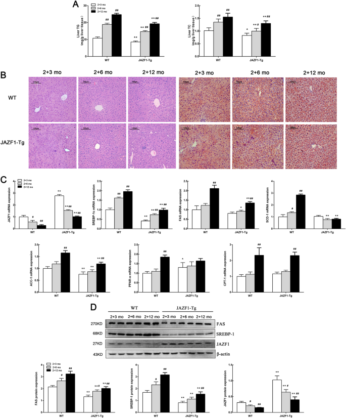 Jazf1 Ameliorates Age And Diet Associated Hepatic Steatosis Through Srebp 1c Dependent Mechanism Cell Death Disease