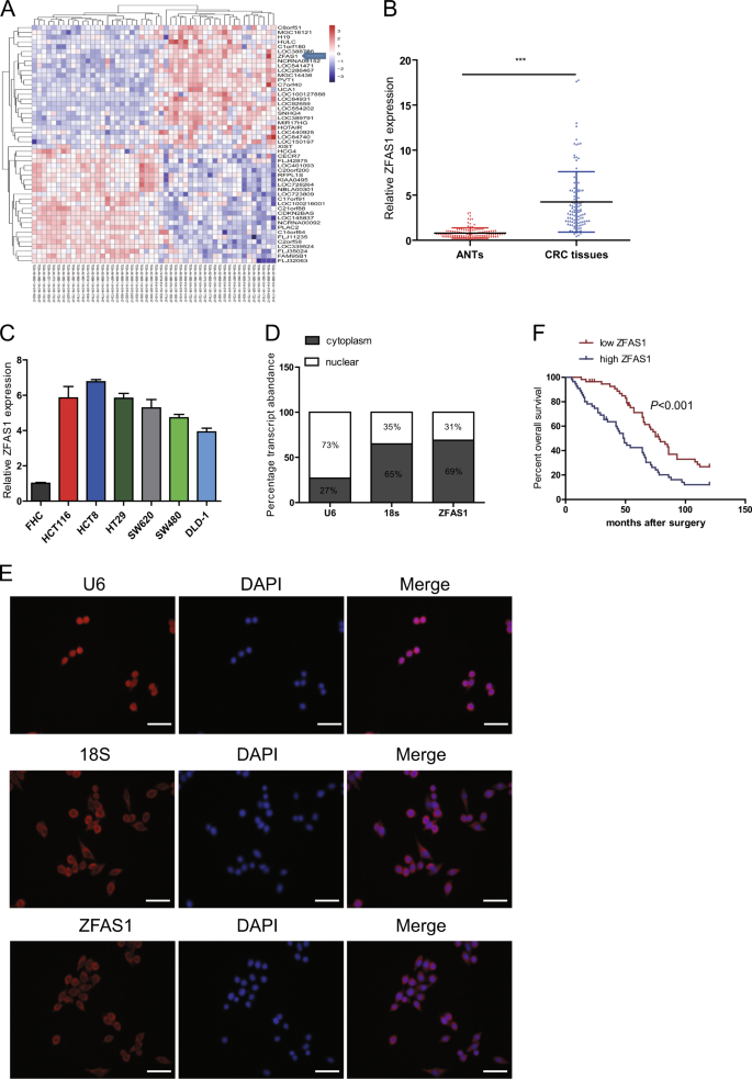 Fig. 1: LncRNA-ZFAS1 was overexpressed in CRC tissues and cells, and is associated with poor overall survival.