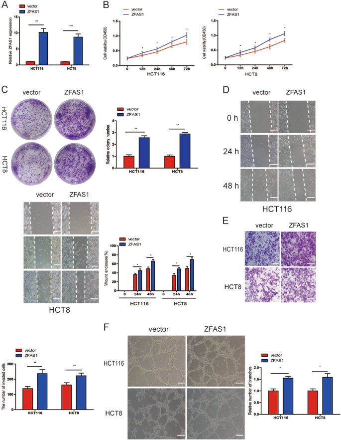 Fig. 3: ZFAS1 upregulation promoted CRC cells growth, migration, invasion, and HUVECs tube formation.