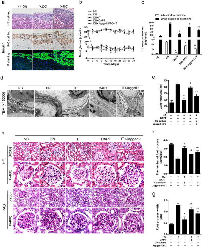 Fig. 3: Activated Notch-1 signaling affected the improvement of renal function and microstructure after islet transplantation