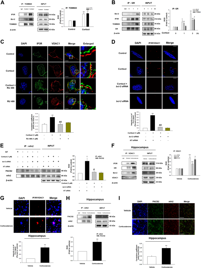 Fig. 3: The effect of cortisol on ER-mitochondria contact via interaction between GR and Bcl-2.