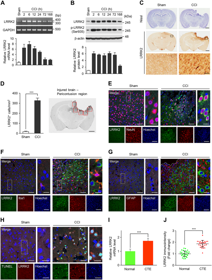 Fig. 1: LRRK2 induction in in vivo TBI models.