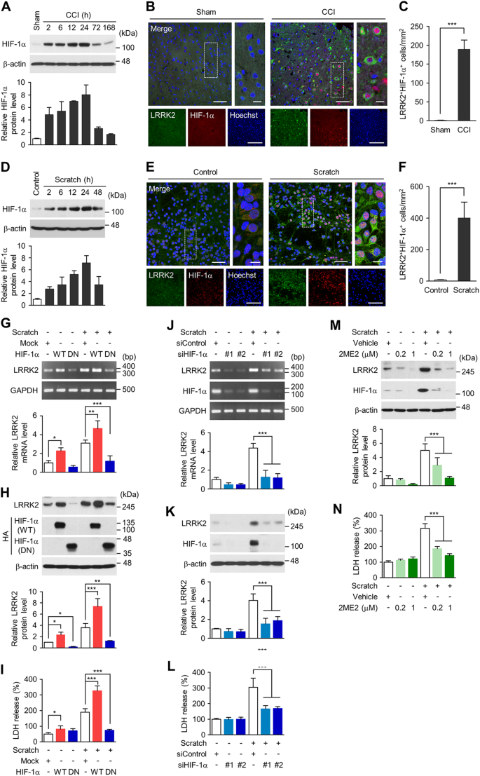 Fig. 3: HIF-1α dependent upregulation of LRRK2.