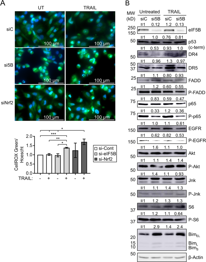 Eukaryotic Initiation Factor 5b Eif5b Provides A Critical Cell Survival Switch To Glioblastoma Cells Via Regulation Of Apoptosis Cell Death Disease