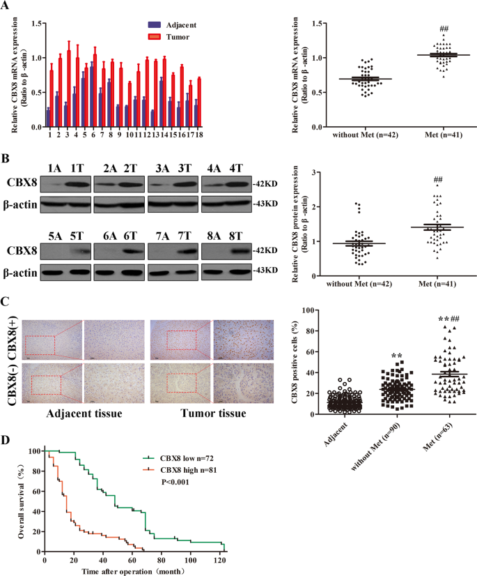 Cbx8 Exhibits Oncogenic Properties And Serves As A Prognostic Factor In Hepatocellular Carcinoma Cell Death Disease Cbx8 Exhibits Oncogenic Properties And Serves As A Prognostic Factor In Hepatocellular Carcinoma Cell Death Disease