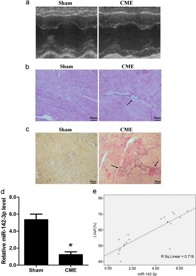 Fig. 1: Downregulation of miR-142-3p in the myocardiac tissue of CME pig.