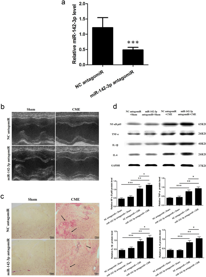 Fig. 3: miR-142-3p inhibition aggravates CME-caused myocardiac injury and CME-induced myocardiac inflammatory response.