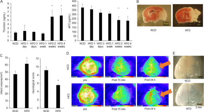 Fig. 7: HFD feeding mice show larger infarct volume and more severe neurological score than NCD mice.