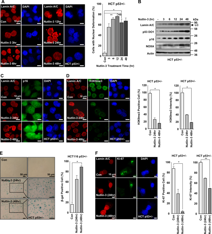 Fig. 2: p53 stabilization induces nuclear deformation, Lamin A/C expression, and p16 expression.