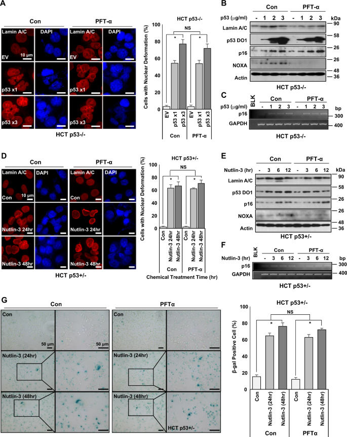 Fig. 3: Transcription activity of p53 is dispensable for nuclear deformation.