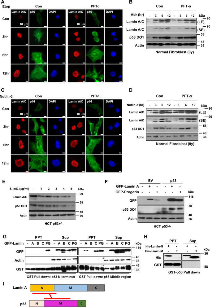 Fig. 5: Wild-type p53 stabilizes Lamin A/C via direct interaction.