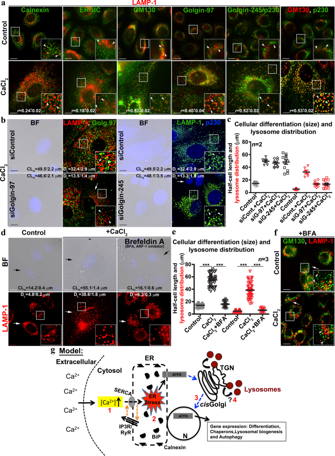 Keratinocyte differentiation promotes ER stress-dependent lysosome 