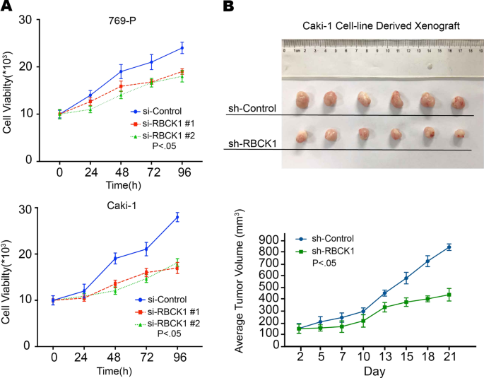 Fig. 3: RBCK1 depletion inhibits RCC proliferation in vivo and in vitro.