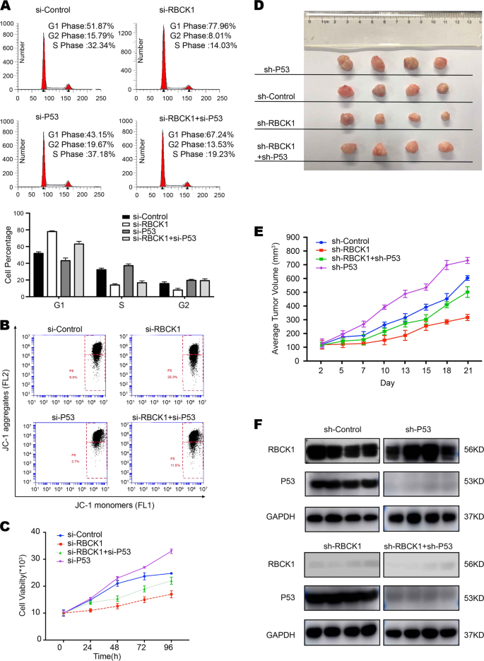 Fig. 6: Biological behavior affected by RBCK1 depletion could be rescued by p53 silencing in vivo/vitro.