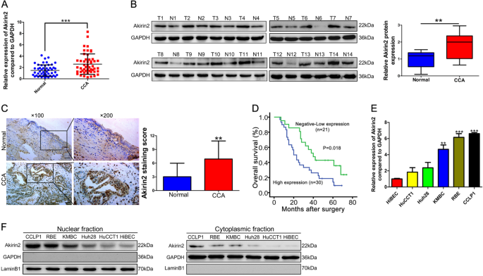 Fig. 1: Akirin2 is upregulated in human cholangiocarcinoma (CCA) and predicts a poor prognosis.