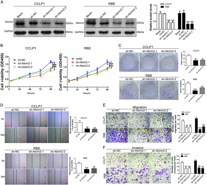 Fig. 2: Knockdown of Akirin2 suppresses the proliferation, migration and invasion of cholangiocarcinoma (CCA) cells in vitro.