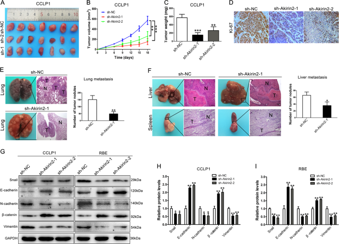 Fig. 3: Knockdown of Akirin2 suppresses tumor growth and metastasis in vivo.