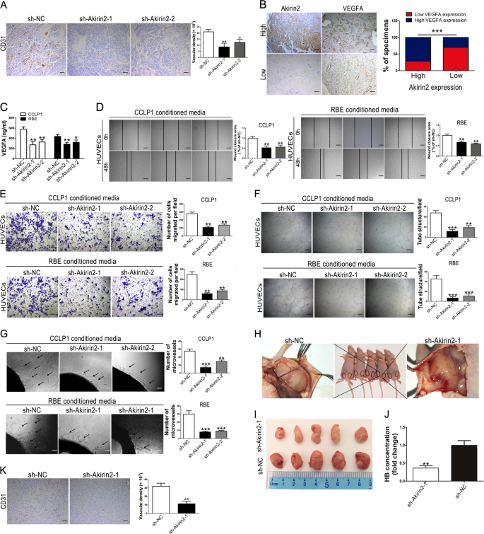 Fig. 4: Akirin2 suppression attenuates tumor angiogenesis in vitro and in vivo.