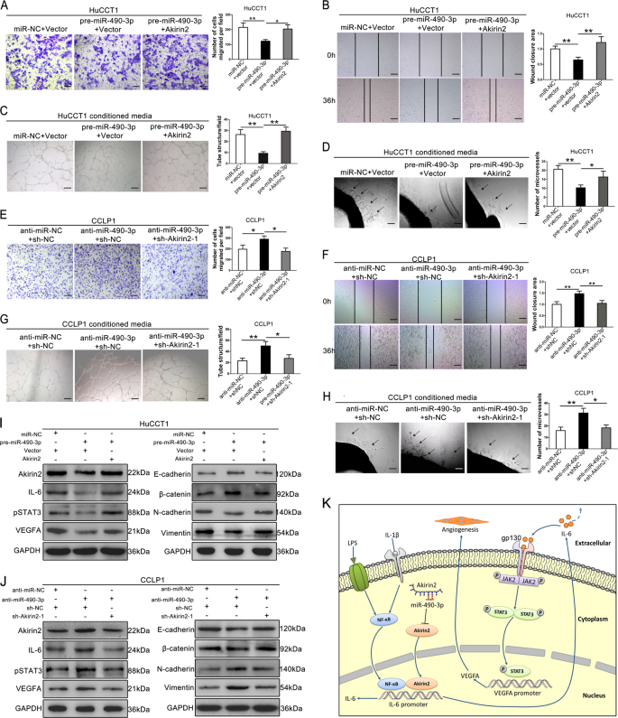 Fig. 7: Akirin2&nbsp;is involved in the miR-490-3p-mediated regulation of cholangiocarcinoma (CCA) migration and angiogenesis.