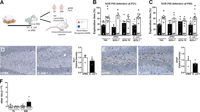 Neonatal Infection Leads To Increased Susceptibility To Ab Oligomer Induced Brain Inflammation Synapse Loss And Cognitive Impairment In Mice Cell Death Disease
