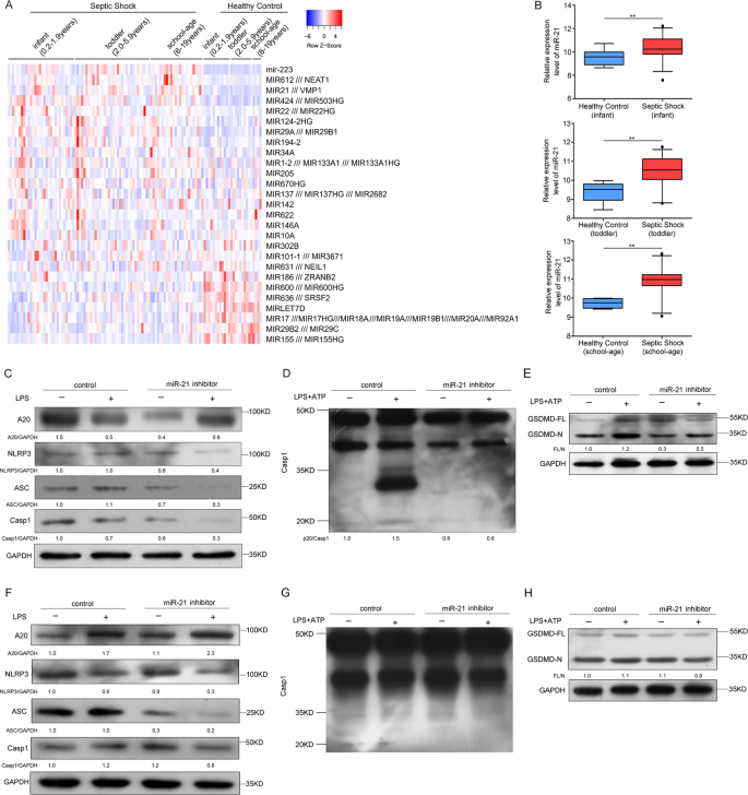 Fig. 7: The role of miR-21 in human septic shock.