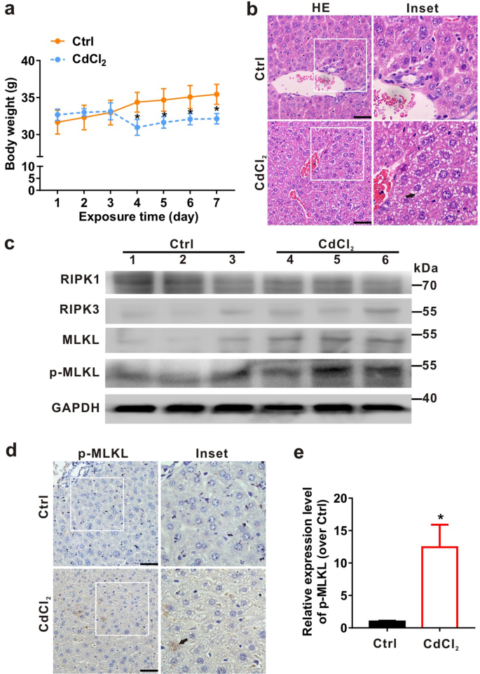 Fig. 1: CdCl2 induces necroptosis in liver tissues of ICR mice.