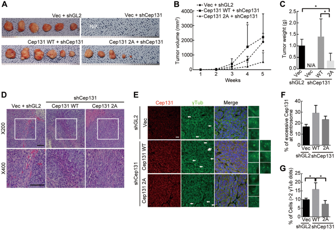 Fig. 7: Overexpression of Cep131 is closely associated with colon cancer progression.