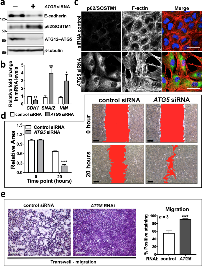 Fig. 3: Autophagy inhibition by ATG5 depletion induces EMT and cell migration in ATII cells.